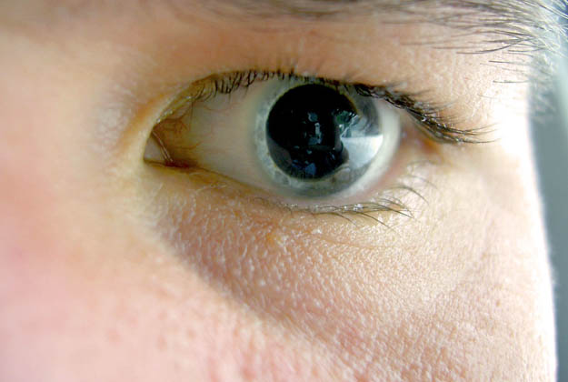 Queratocono. Enfermedades y tratamientos para los problemas oculares por el Instituto Oftalmológico Recoletas. 