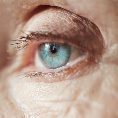 Esclerectomía profunda no perforante. Enfermedades y tratamientos para los problemas oculares por el Instituto Oftalmológico Recoletas.