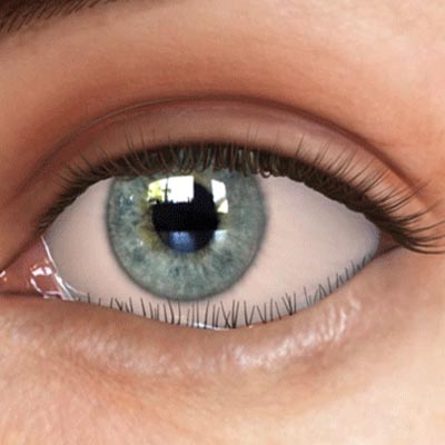 Entropión. Enfermedades y tratamientos para los problemas oculares por el Instituto Oftalmológico Recoletas.
