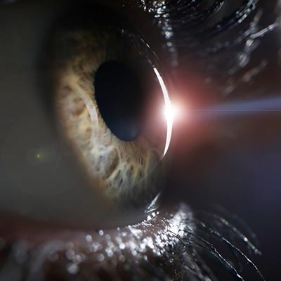 Esclerectomía profunda no perforante. Enfermedades y tratamientos para los problemas oculares por el Instituto Oftalmológico Recoletas.