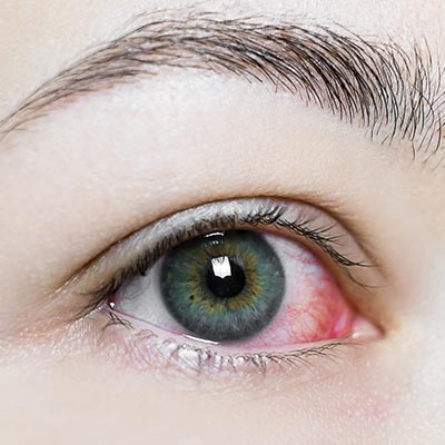 Vitrectomía pars plana. Enfermedades y tratamientos para los problemas oculares por el Instituto Oftalmológico Recoletas.