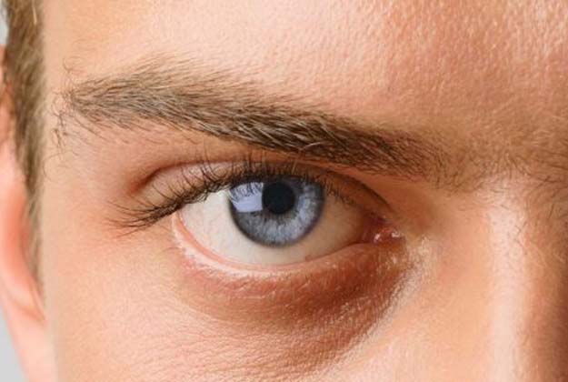 Alta miopía. Enfermedades y tratamientos para los problemas oculares por el Instituto Oftalmológico Recoletas.