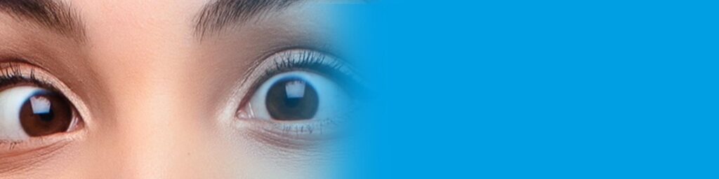 Estrabismo del adulto. Enfermedades y tratamientos para los problemas oculares por el Instituto Oftalmológico Recoletas.
