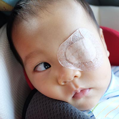 Estrabismo infantil. Enfermedades y tratamientos para los problemas oculares por el Instituto Oftalmológico Recoletas.