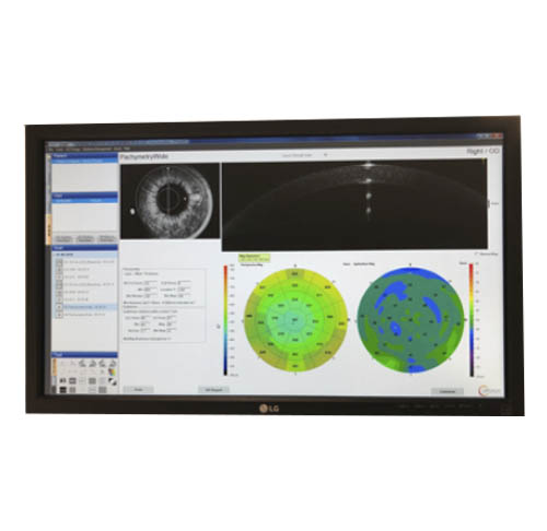 Tomografía de coherencia óptica de segmento anterior OCT-AS. Instalaciones y equipación para los problemas oculares del Instituto Oftalmológico Recoletas.