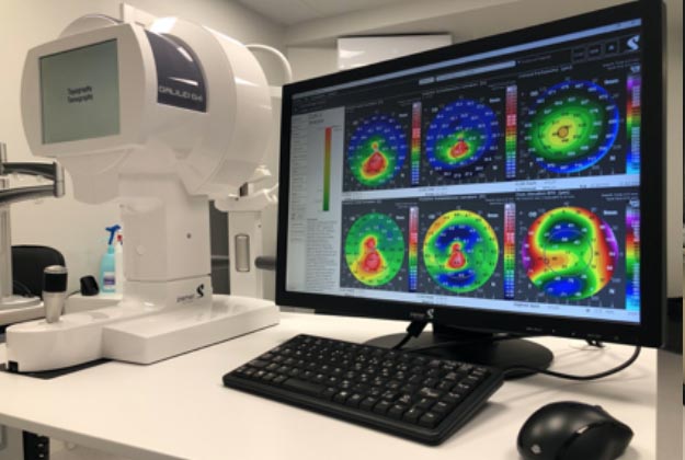 OCT o Tomografía de coherencia óptica. Instalaciones y equipación para los problemas oculares del Instituto Oftalmológico Recoletas.