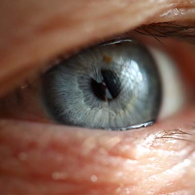 Retinosis pigmentaria. Enfermedades y tratamientos para los problemas oculares por el Instituto Oftalmológico Recoletas.