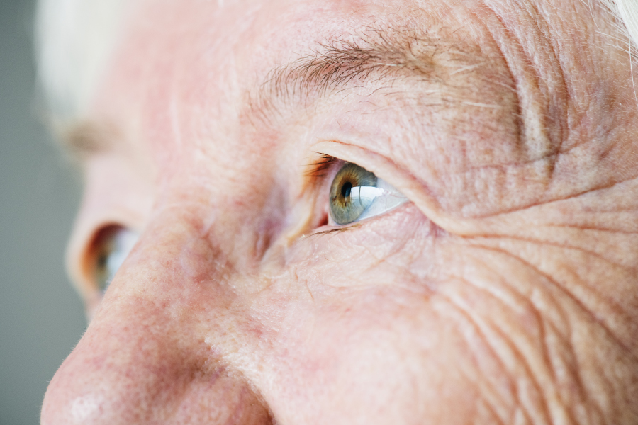 Hipertensión ocular: qué es, síntomas y tratamiento