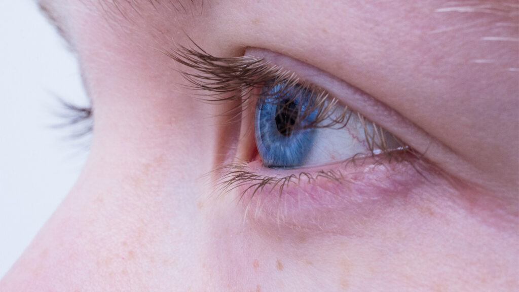 Midriasis: la dilatación de la pupila. IOR