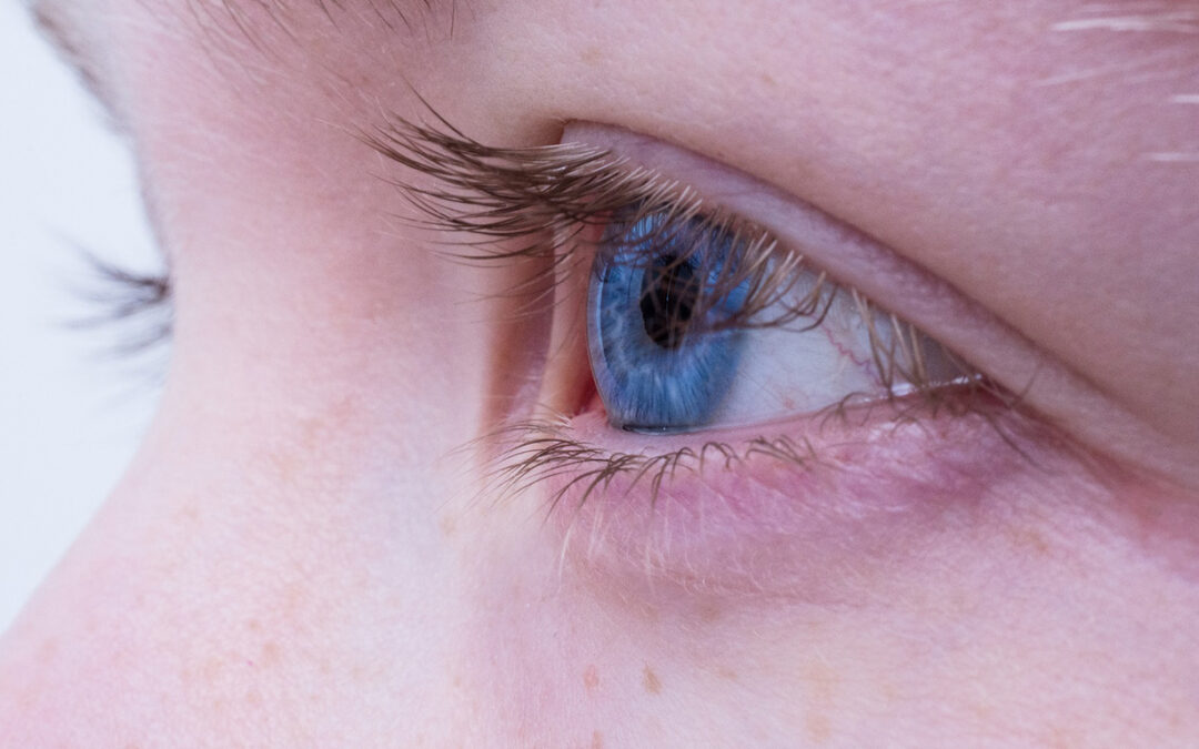 Midriasis: dilatación de la pupila