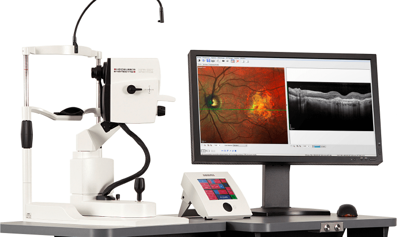 Láser de femtosegundo. Enfermedades y tratamientos para los problemas oculares por el Instituto Oftalmológico Recoletas.